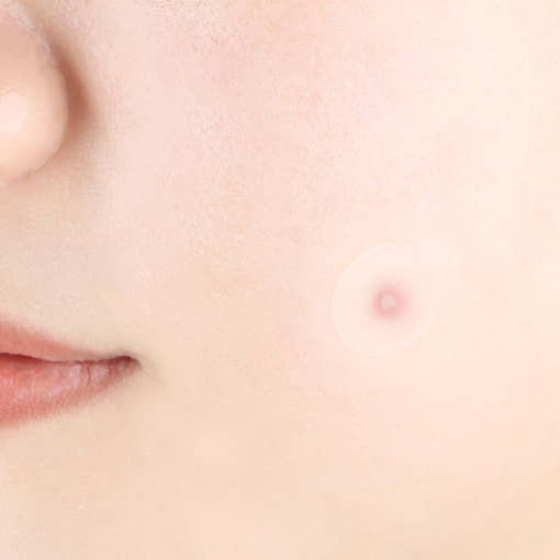 [Pyunkang Yul] Clear Spot Patch (18ea X 4ea) - LUUELA